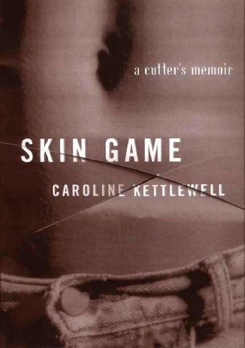 Skin Game: A Memoir