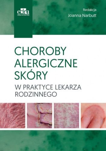 Choroby alergiczne skóry w praktyce lekarza rodzinnego